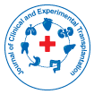Journal of Clinical and Experimental Transplantation